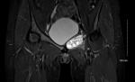 0 NMSP Circulation A21 - Bone case B1a.jpg